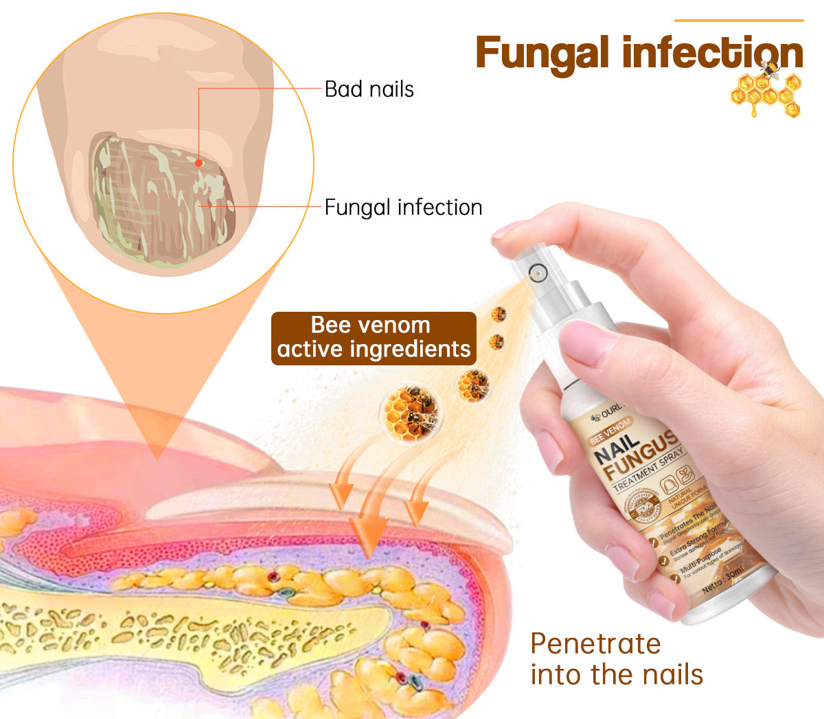🐝🐝Ourlyard™ Bee Venom Nail Fungus Treatment Spray