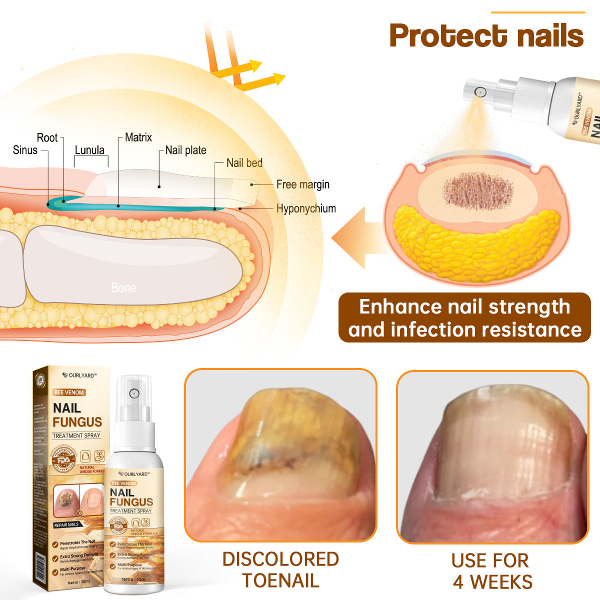 🐝🐝Ourlyard™ Bee Venom Nail Fungus Treatment Spray