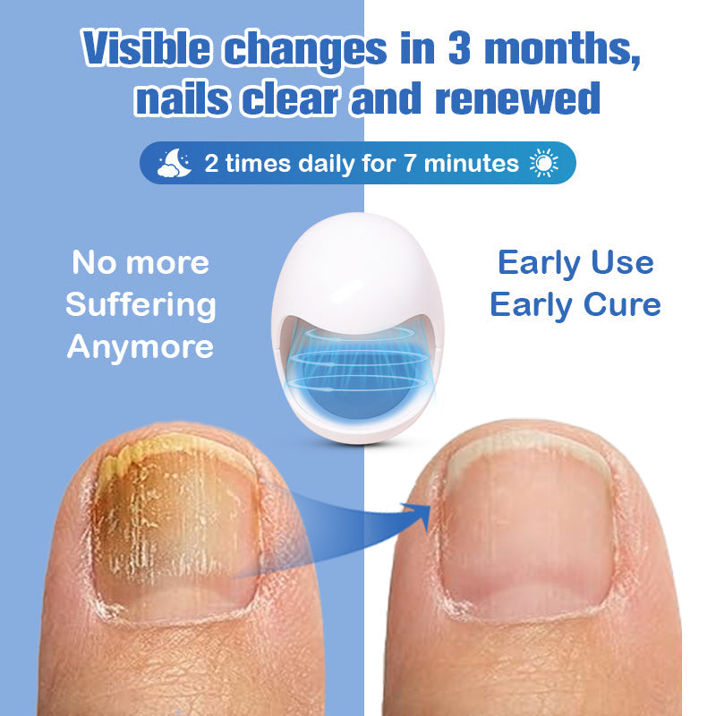 Furzero™ Nail Fungus Cleaning Laser Device