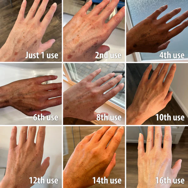 đFurzero⢠OceanCure Bee Venom Psoriasis & Wart Healing Cream