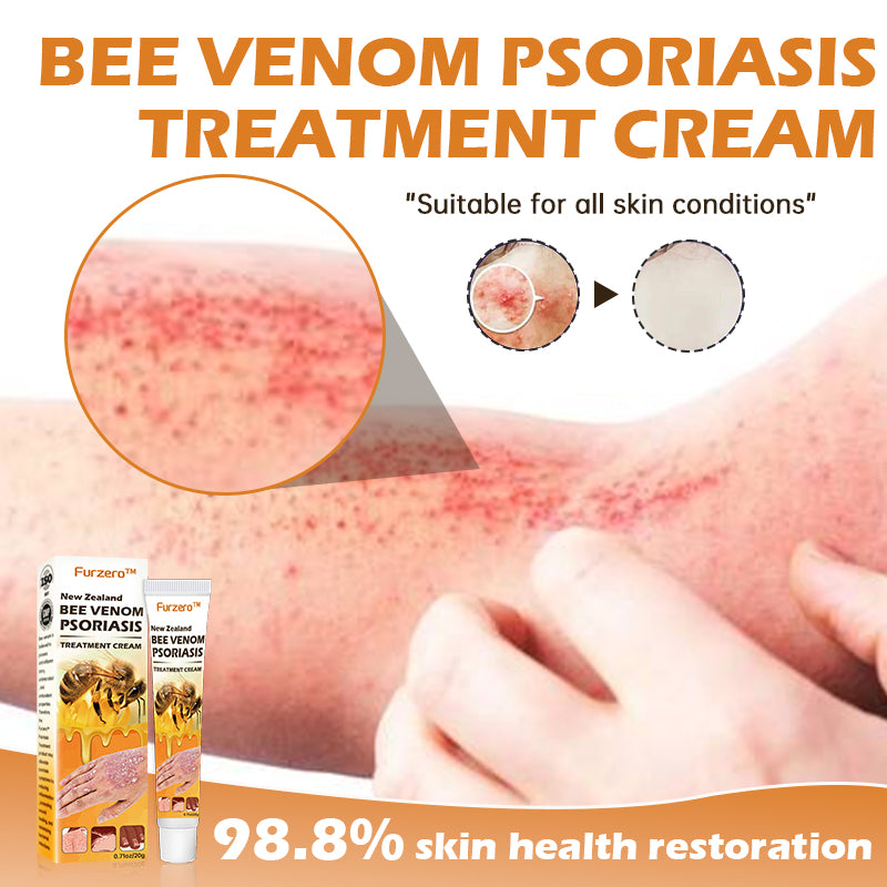 Furzero™ New Zealand Bee Venom Psoriasis Treatment Cream(Suitable for all skin conditions)