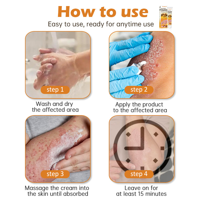 Furzero™ New Zealand Bee Venom Psoriasis Treatment Cream(Suitable for all skin conditions)