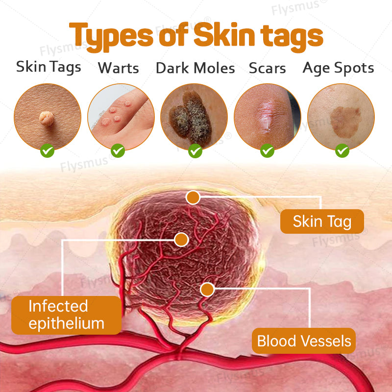 🌿Flysmus® Tag Recede Bee Venom Treatment Cream-LAST DAY 70% OFF-Maximize Skin Renewal