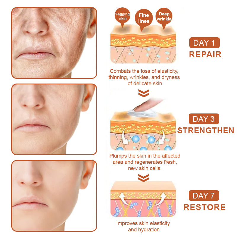 Flysmus™ BotoxBee Wrinkle Removal Cream