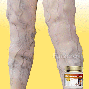 🍀【👨⚕𝑨𝑨𝑫 𝑹𝑬𝑪𝑶𝑴𝑴𝑬𝑵𝑫𝑺】Furzero™ Bee Venom Advanced joint and bone therapy cream (✨ for joint pain and varicose veins✨)