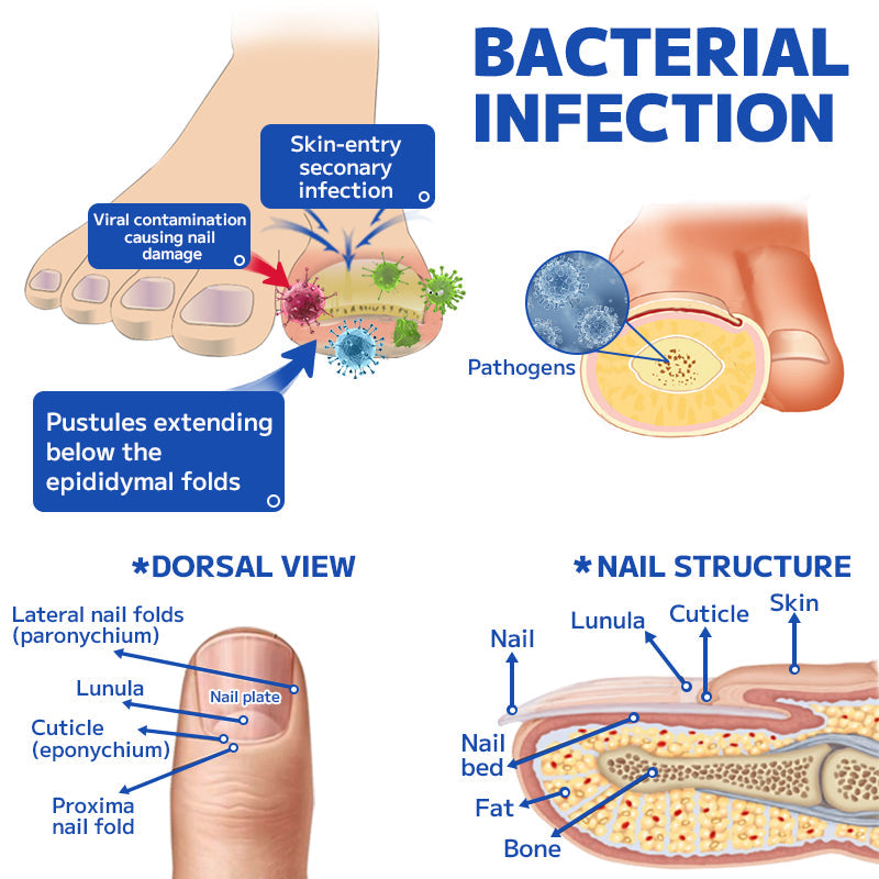š„Furzero⢠Fungal Nail Treatment Laser Device
