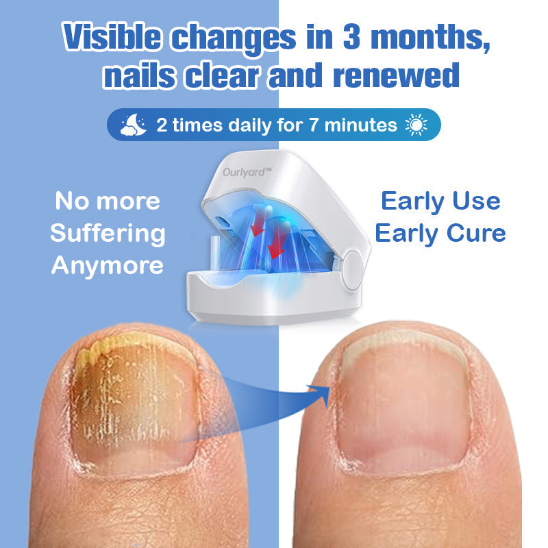 Furzero™ Nail Fungus Laser Therapy Device T
