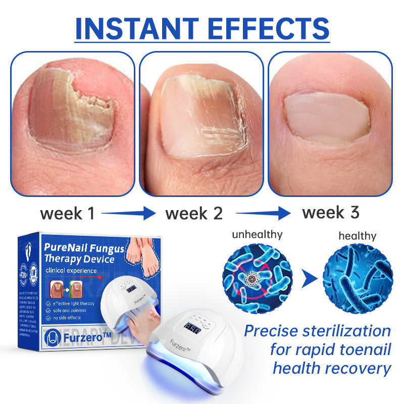 Furzero™ PureNail Fungus Laser Therapy Device Pro