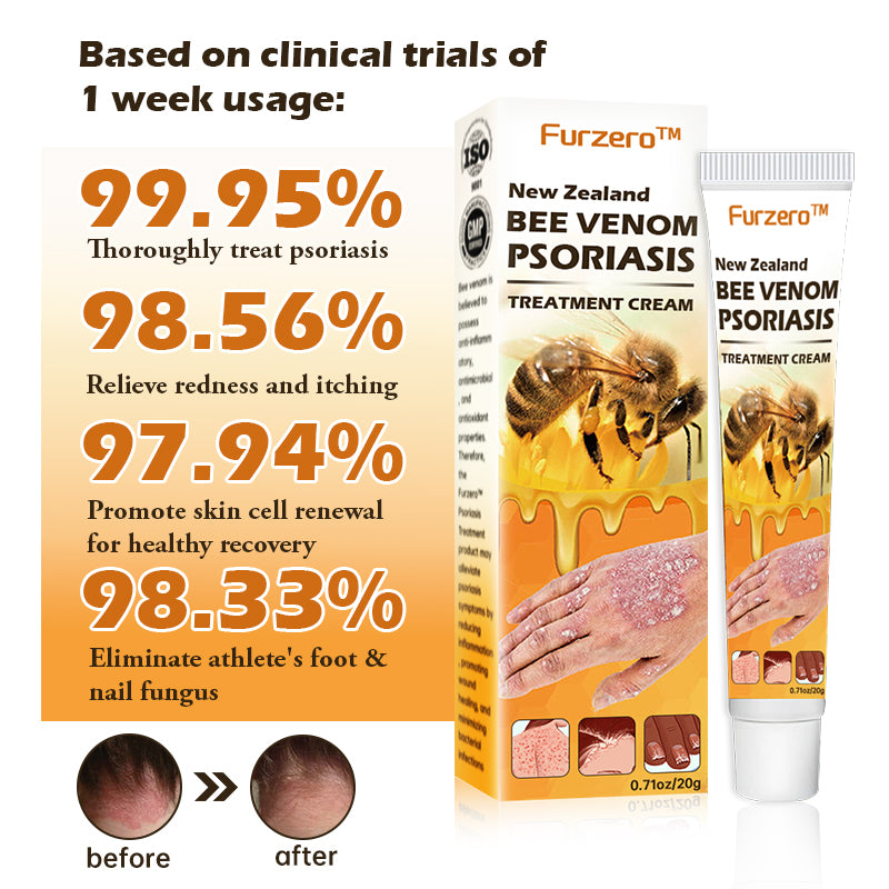 Furzero™ New Zealand Bee Venom Psoriasis Treatment Cream(Suitable for all skin conditions)