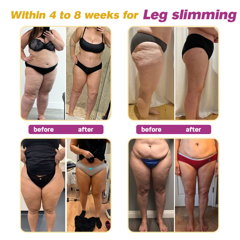 đFurzero⢠BeeVenom Fat Burner Cream