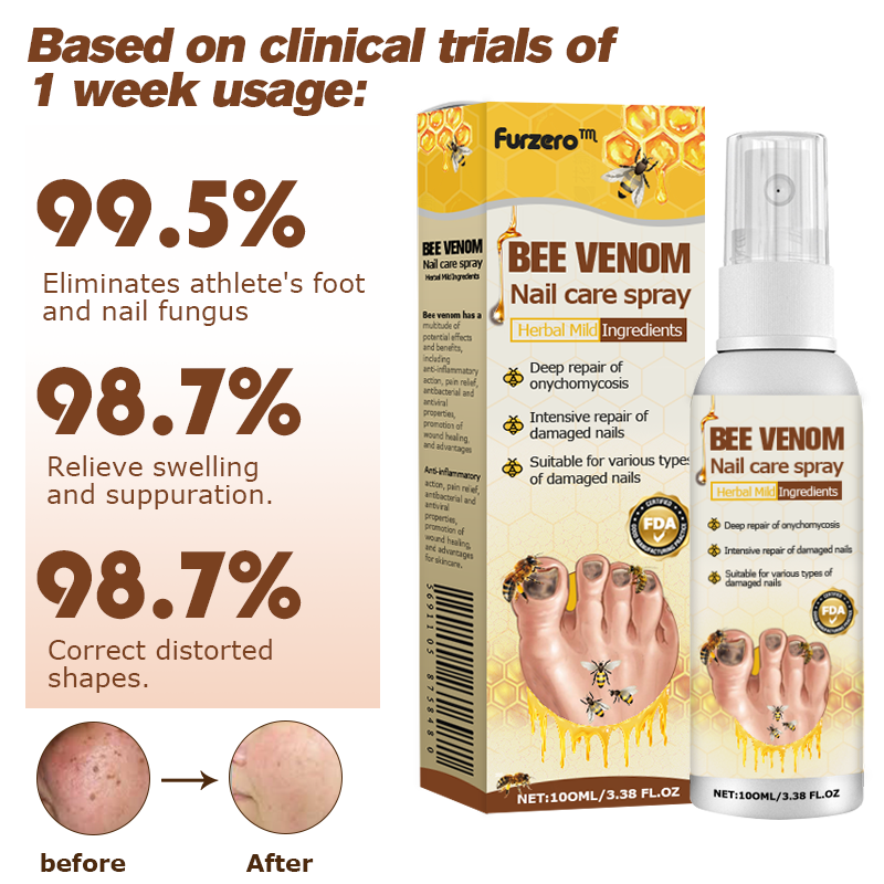🐝Furzero™ Bee Venom Nail Psoriasis Treatment Spray