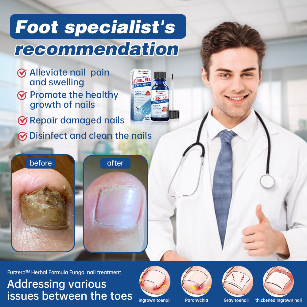 Furzero™ Herbal Formula Fungal nail Paronychia treatment Gel Pro