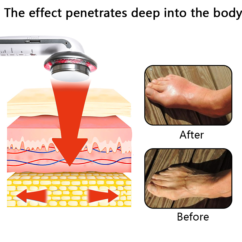 Ourlyard™ Handheld Cold Laser Pain Therapy Device Plus