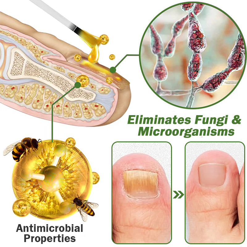 šFurzero⢠Nail Defense Bee Venom Treatment Serum (For All Kinds Of Nail Diseasesā
For Healthier Nail Growth)