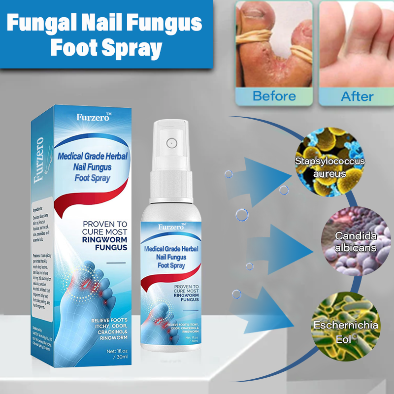 Furzero™ Advanced Medical Grade Herbal Nail Fungus Foot Spray