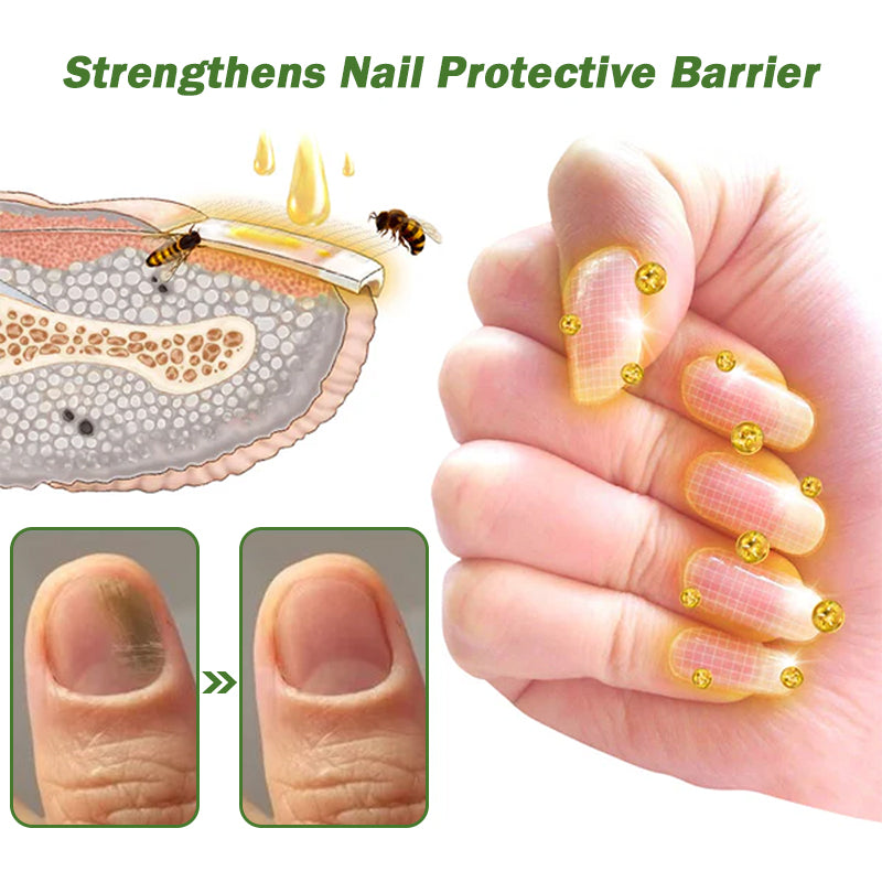 šFurzero⢠Nail Defense Bee Venom Treatment Serum (For All Kinds Of Nail Diseasesā
For Healthier Nail Growth)