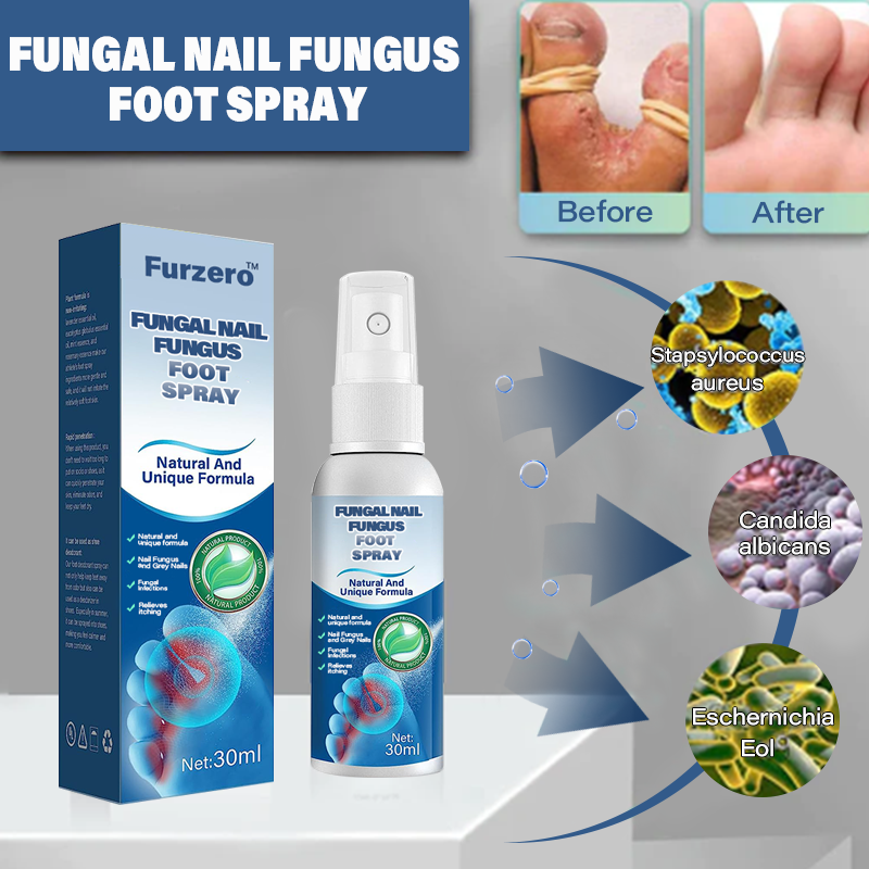 Furzero™ Medical Grade Nail Fungus Foot Strengthening Spray