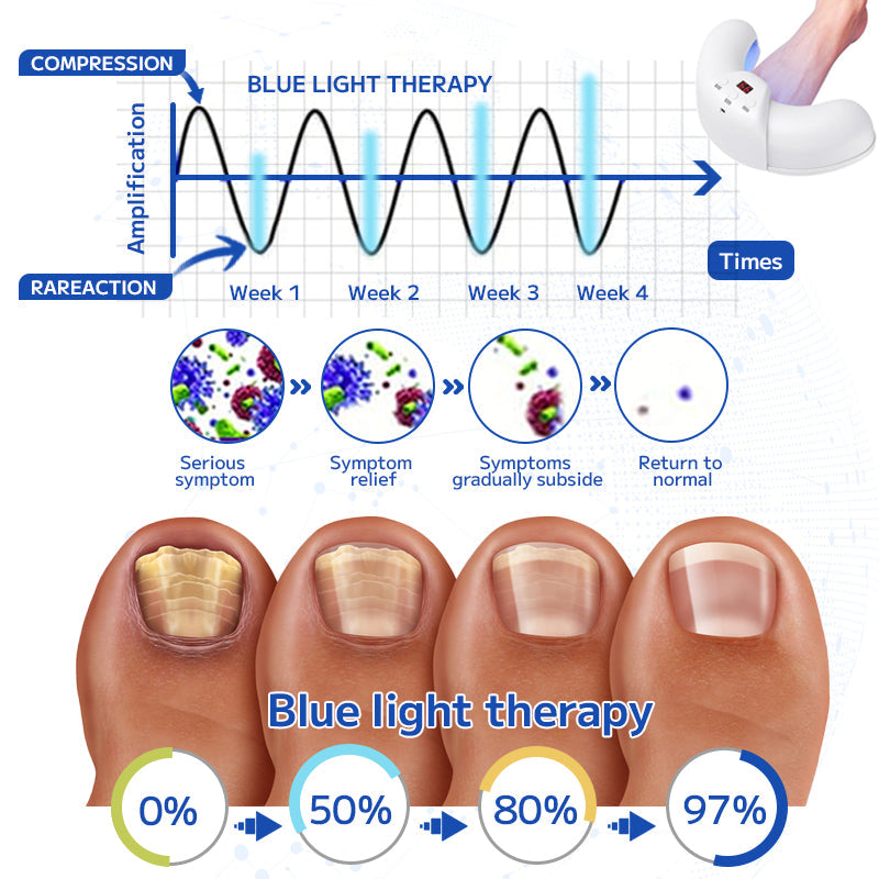 š„Furzero⢠Fungal Nail Treatment Laser Device
