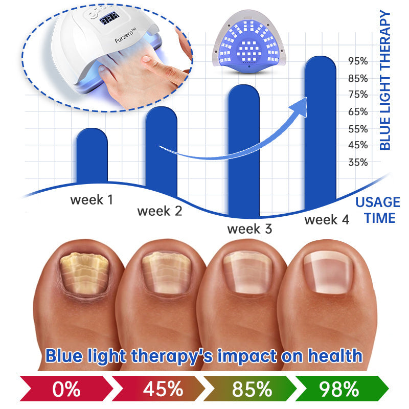 Furzero™ PureNail Fungus Laser Therapy Device Pro