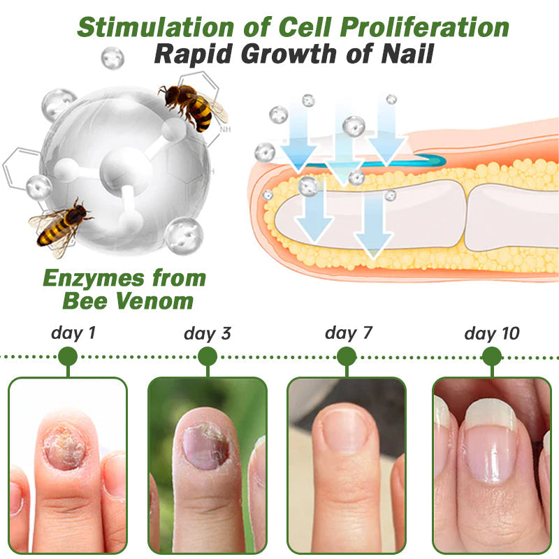 šFurzero⢠Nail Defense Bee Venom Treatment Serum (For All Kinds Of Nail Diseasesā
For Healthier Nail Growth)