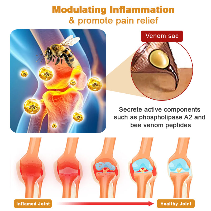 🍀【👨⚕𝑨𝑨𝑫 𝑹𝑬𝑪𝑶𝑴𝑴𝑬𝑵𝑫𝑺】Furzero™ Bee Venom Advanced joint and bone therapy cream (✨ for joint pain and varicose veins✨)