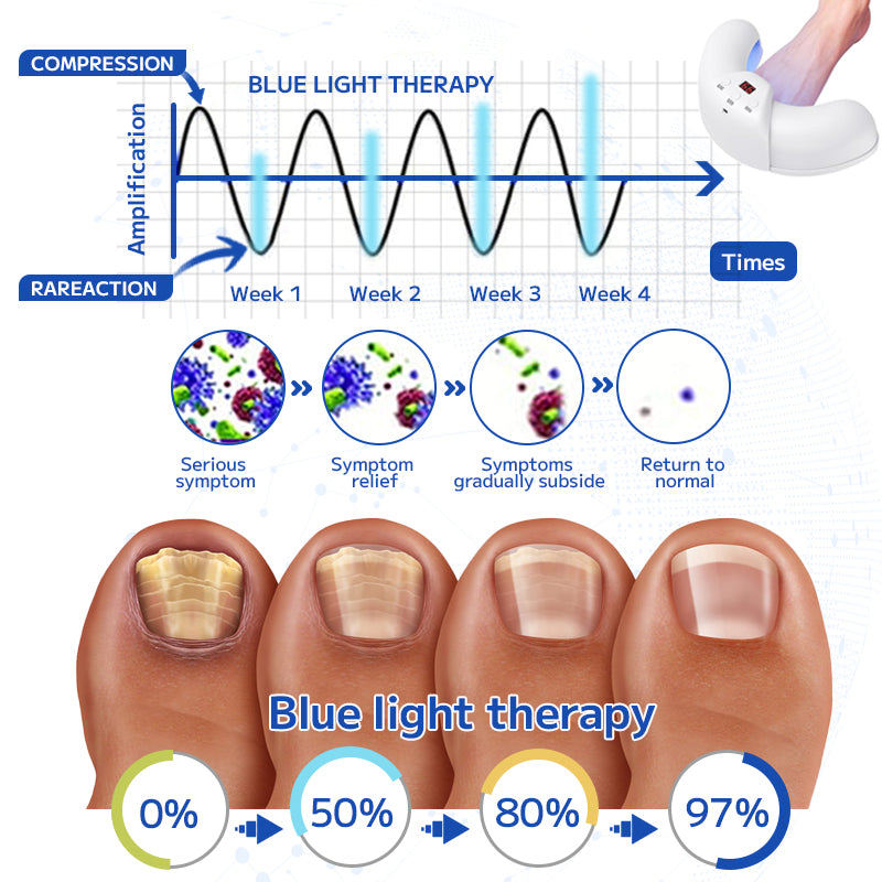 Furzero™ Fungal Nail Treatment Laser Device