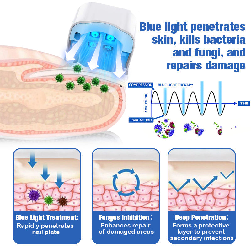👏Furzero™ Nail Fungus Laser Therapy Device Hot Sale