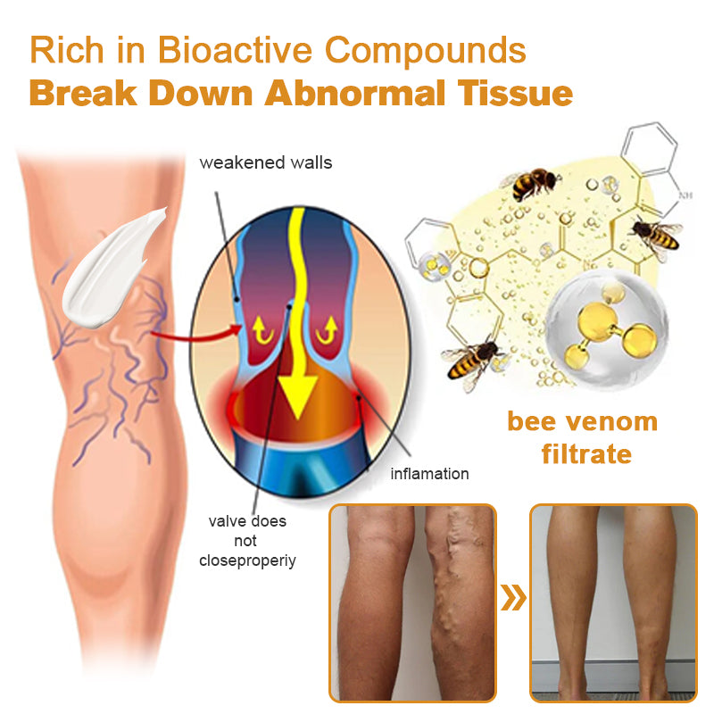 🍀【👨⚕𝑨𝑨𝑫 𝑹𝑬𝑪𝑶𝑴𝑴𝑬𝑵𝑫𝑺】Furzero™ Bee Venom Advanced joint and bone therapy cream (✨ for joint pain and varicose veins✨)