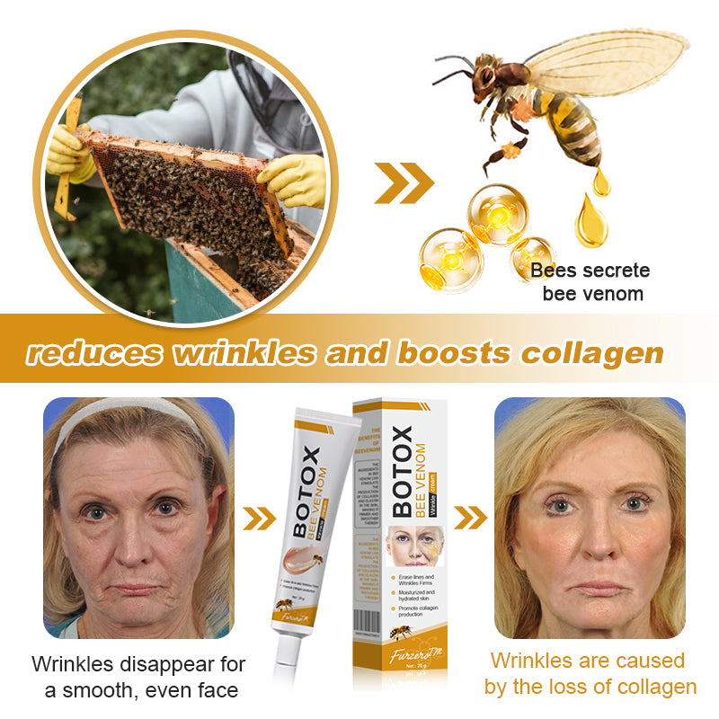 šš©āāļøFDA Approvedā
Furzero⢠Botox Bee Venom Wrinkle Removal Cream-š„LAST DAY 70% OFF-āØMade and Shipped from USA