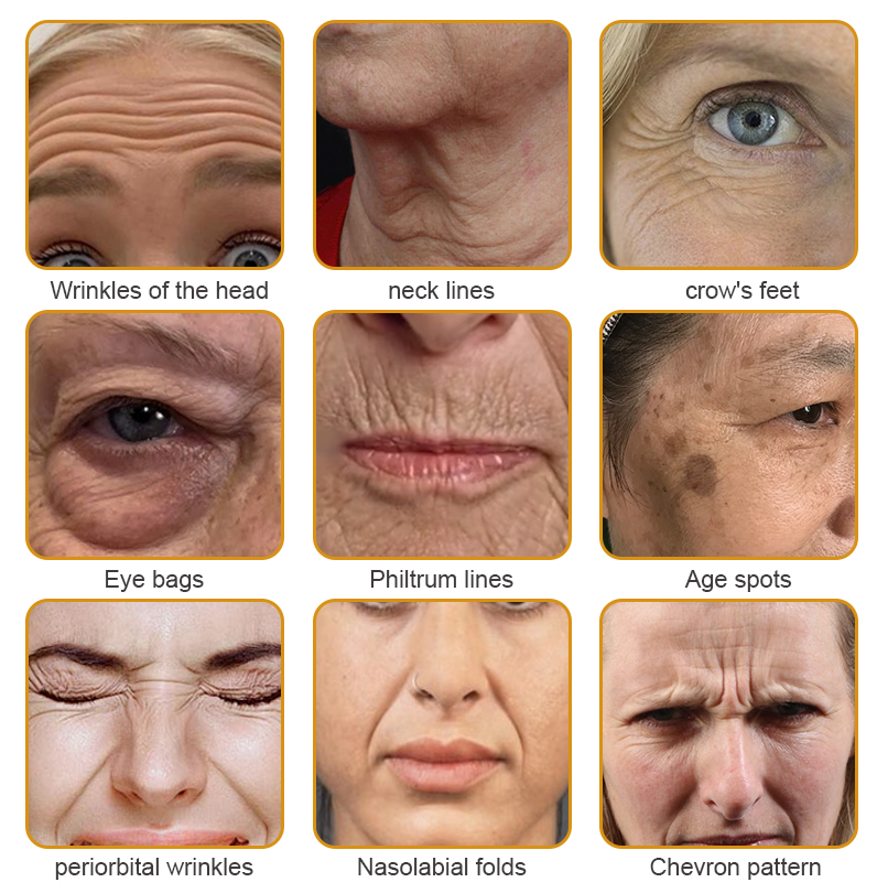 šš©āāļøFDA Approvedā
Furzero⢠Botox Bee Venom Wrinkle Removal Cream-š„LAST DAY 70% OFF-āØMade and Shipped from USA