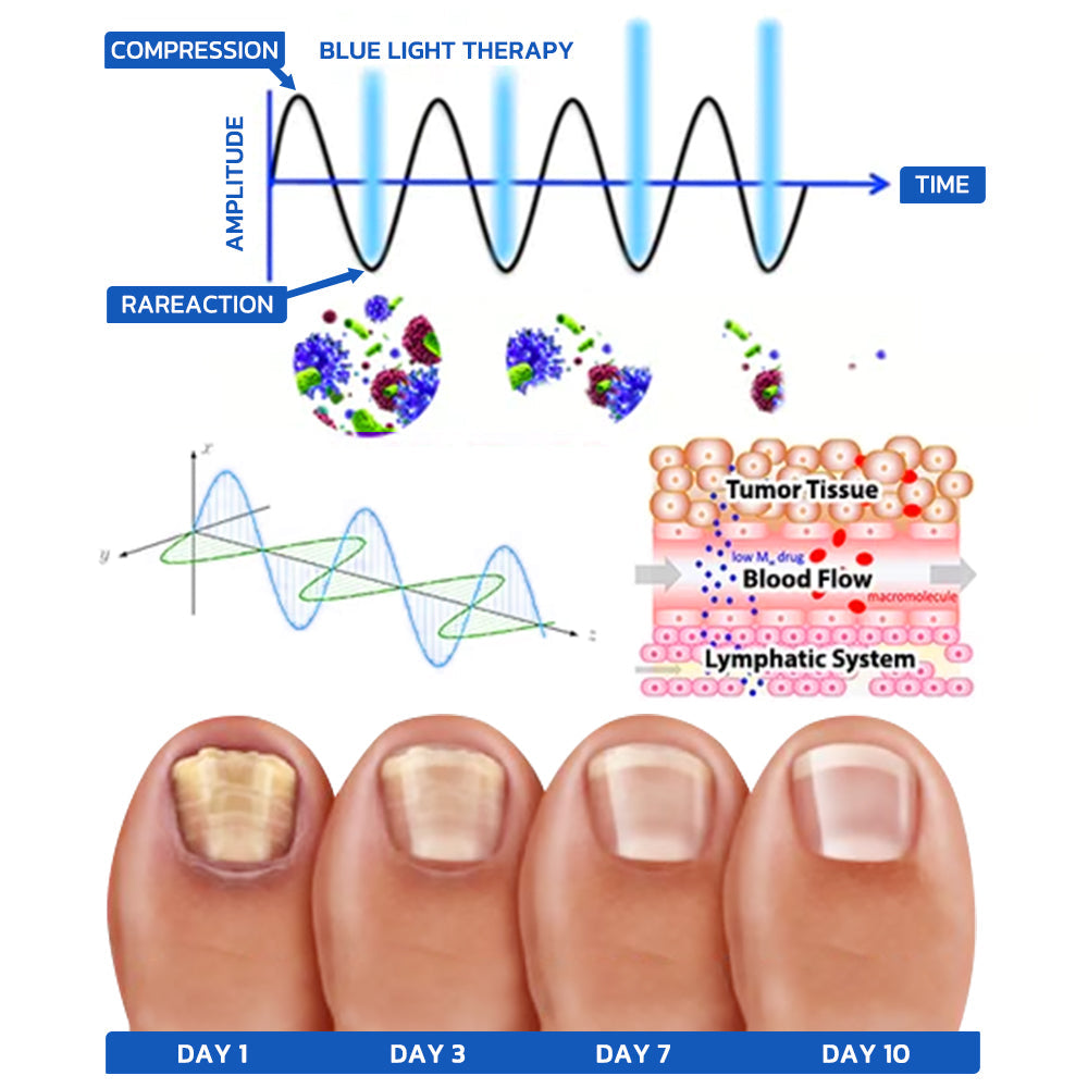 Furzero™ Nail Fungus Cleaning Laser Device
