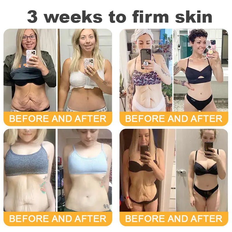 โจFDA Approved-๐
๐ฅ๐ฒ๐ฌ๐ฆ๐ฎ๐ฌโข ๐๐๐ฏ๐๐ง๐๐๐ ๐๐จ๐ฅ๐ฅ๐๐ ๐๐ง ๐๐๐ฉ๐ญ๐ข๐๐ ๐
๐ข๐ซ๐ฆ๐ข๐ง๐ ๐๐ซ๐๐๐ฆ, ๐๐๐๐ซ๐๐ฌ๐ฌ ๐๐ซ๐๐ฉ๐ & ๐๐๐ ๐ ๐ข๐ง๐ ๐ฅ ๐๐๐ฌ๐ญ ๐๐๐ฒ ๐๐ข๐ฌ๐๐จ๐ฎ๐ง๐ญ -๐๐% ๐๐
๐