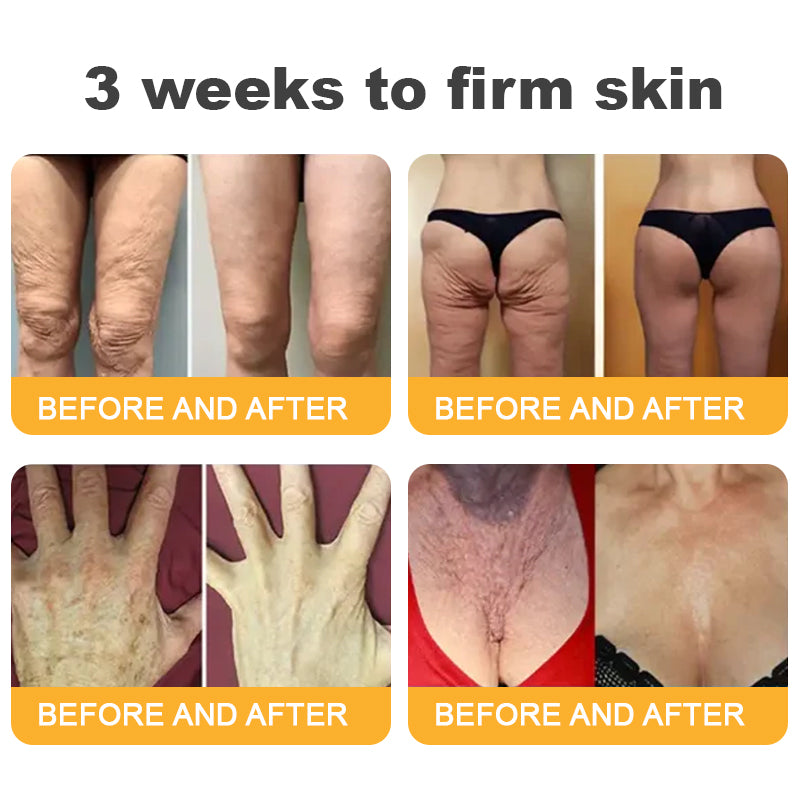 โจFDA Approved-๐
๐ฅ๐ฒ๐ฌ๐ฆ๐ฎ๐ฌโข ๐๐๐ฏ๐๐ง๐๐๐ ๐๐จ๐ฅ๐ฅ๐๐ ๐๐ง ๐๐๐ฉ๐ญ๐ข๐๐ ๐
๐ข๐ซ๐ฆ๐ข๐ง๐ ๐๐ซ๐๐๐ฆ, ๐๐๐๐ซ๐๐ฌ๐ฌ ๐๐ซ๐๐ฉ๐ & ๐๐๐ ๐ ๐ข๐ง๐ ๐ฅ ๐๐๐ฌ๐ญ ๐๐๐ฒ ๐๐ข๐ฌ๐๐จ๐ฎ๐ง๐ญ -๐๐% ๐๐
๐