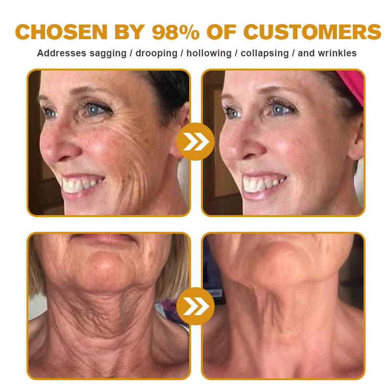 Last Day Promotion 70% OFF - ✨Furzero™ Botox Bee Venom Wrinkle Removal Cream