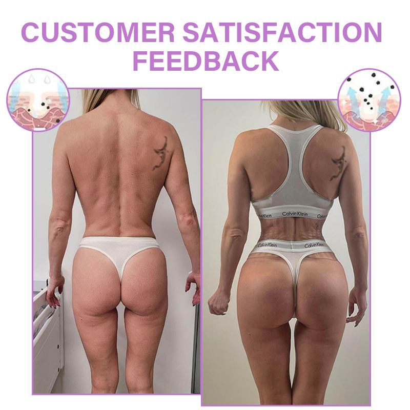 Furzero™ Bottom Enhancement Posterior Shaping Cream Pro