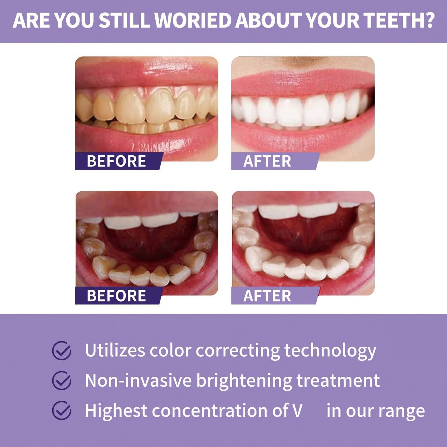Furzero™ Purple Whitening Repair Toothpaste
