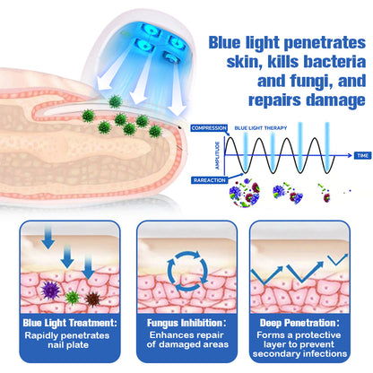 Furzero™ Nail Fungus Cleaning Laser Relief Device