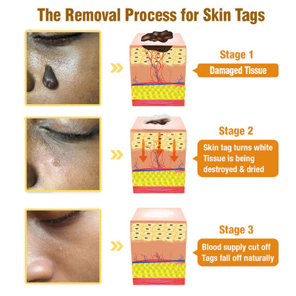 ✨flysmus™ Bee Venom Tags Removal Cream