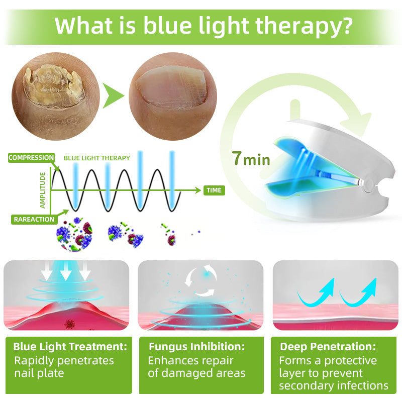 Furzero™ Nail Fungus Laser Therapy Device Max